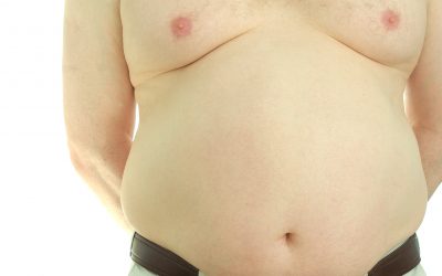 Male Breast Reduction in Newcastle
